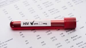 Alarma por el VIH en 2023, una muerte cada minuto y nuevas infecciones en aumento 15 Alarma por el VIH en 2023, una muerte cada minuto y nuevas infecciones en aumento