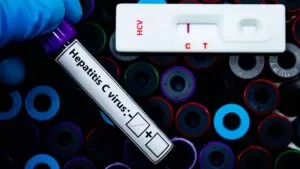 Primera prueba de autodiagnóstico de la hepatitis C ha sido precalificada por la OMS 16 Primera prueba de autodiagnóstico de la hepatitis C ha sido precalificada por la OMS