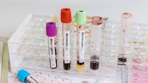 OPS pide a la Américas reforzar vigilancia ante la posible propagación de nueva variante del virus mpox detectada en África
