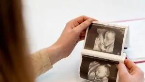 Embarazo adolescente en México: entre la disminución y las brechas sociales 2 Embarazo adolescente en México entre la disminución y las brechas sociales
