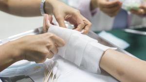 Cifra de quemados con pólvora asciende a 260 en Colombia: Antioquia y Bogotá registran el mayor número de casos 18 12 menos quemados por pólvora en lo corrido de diciembre de 2019